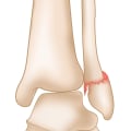 The Intriguing Anatomy of the Ankle Joint