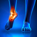 Expert Insights: Understanding Ankle Pain and How to Treat It