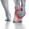 Plantar Fasciitis or Fallen Arches? How to Tell the Difference and Seek the Right Care