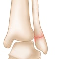 The Crucial Role of the Ankle Joint in Our Daily Movements