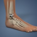 The Complex Anatomy of the Ankle Joint