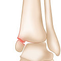 The Complex Anatomy of the Ankle