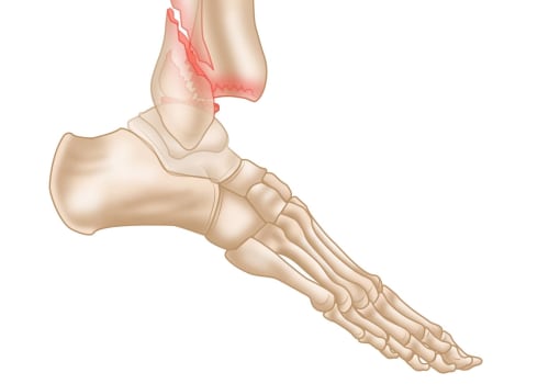 The Ankle: A Comprehensive Guide for Medical Professionals