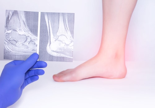 Managing Weak Ankles: Causes and Treatment Options