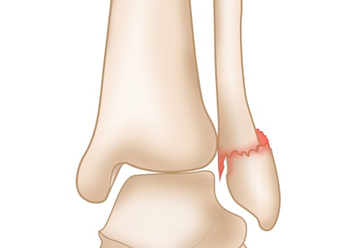 The Fascinating World of the Ankle Joint: Anatomy and Function