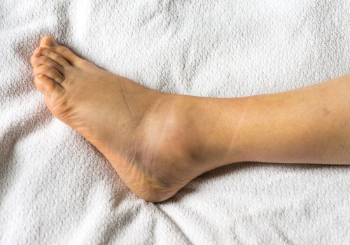 Ankle Pain: Causes, Treatment, and Prevention