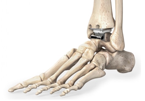 The Intricate Anatomy of the Ankle Joint