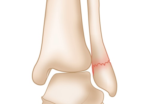 The Crucial Role of the Ankle Joint in Our Daily Movements