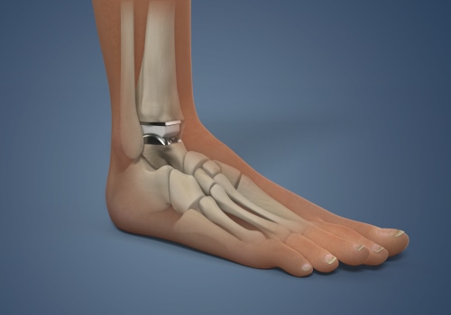 The Complex Anatomy of the Ankle Joint