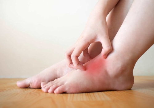 Why Does My Foot Have Red Spots? Diagnosing Foot Issues With an Ankle Specialist's Expertise